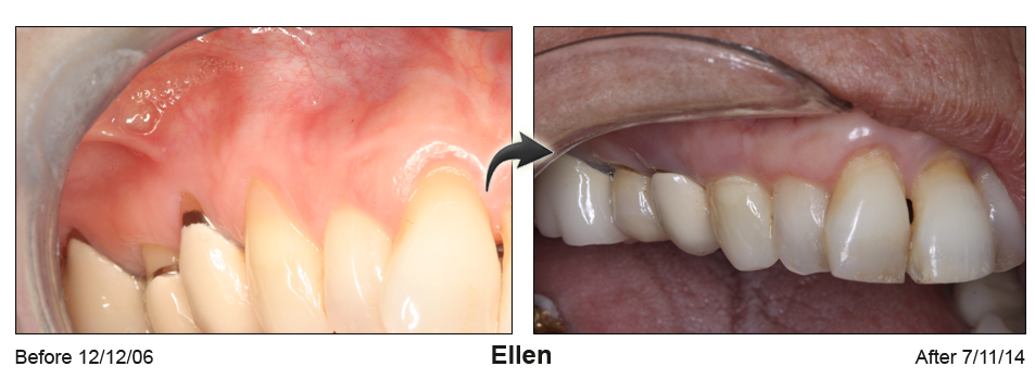 Before and Afte picture